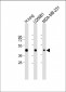 HLA-F Antibody (Center)
